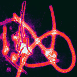 Partículas de virus do ébola